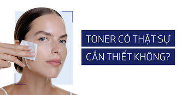 toner-co-can-thiet-khong