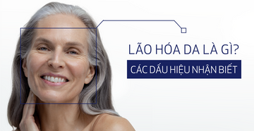 lao-hoa-da-la-gi