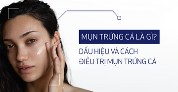 mun-trung-ca