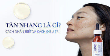Tàn nhang là gì? Nguyên nhân, dấu hiệu và cách điều trị