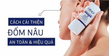 Cách hỗ trợ trị đốm nâu trên gò má trong chu trình skincare