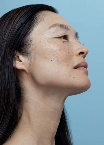 Sau khi peel da nên dùng serum nào? 3 sản phẩm phục hồi tốt nhất