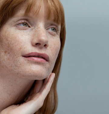 da-mat-bi-troc-vay-trang