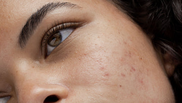 dung-retinol-bao-lau-thi-ngung
