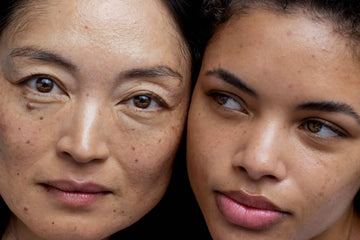 Da nhiễm Corticoid: Nguyên nhân và cách phục hồi an toàn