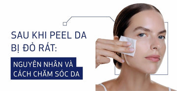 Sau khi peel da bị đỏ rát: Nguyên nhân và cách chăm sóc da