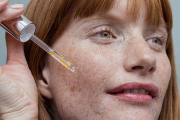Vì sao da bị tăng sắc tố sau laser? Cách điều trị hiệu quả