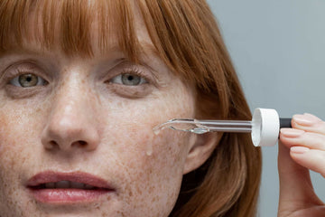 Vì sao nhiều người không có mụn? Cách ngăn ngừa mụn cho da