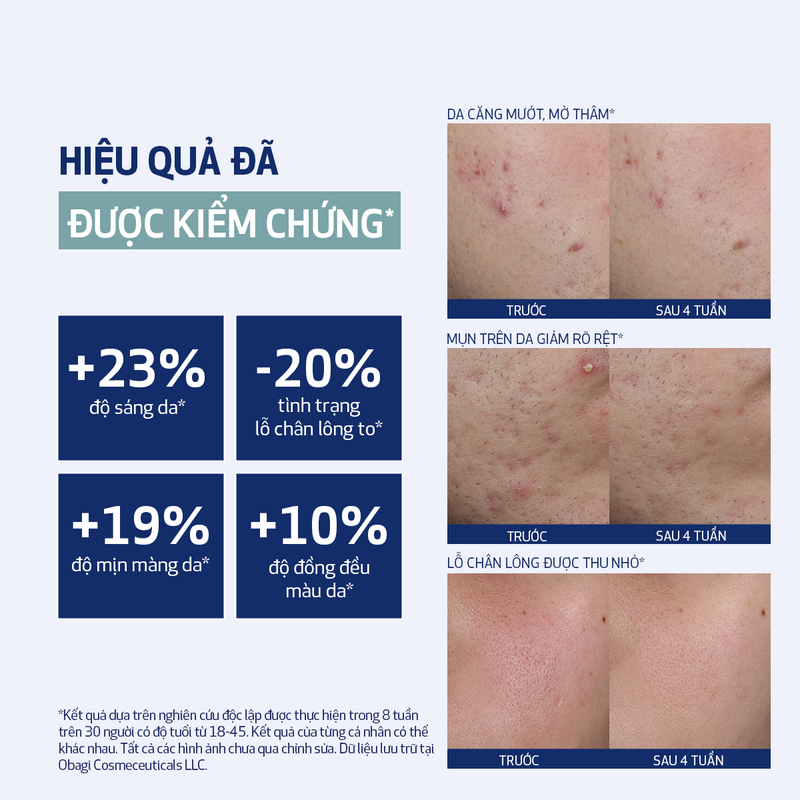 [FLASH SALE] Hộp 30 Miếng pad peel da làm sạch tế bào da chết và cải thiện bề mặt căng bóng CLENZIDERM M.D.® RESURFACING MULTI-ACID (30 miếng)