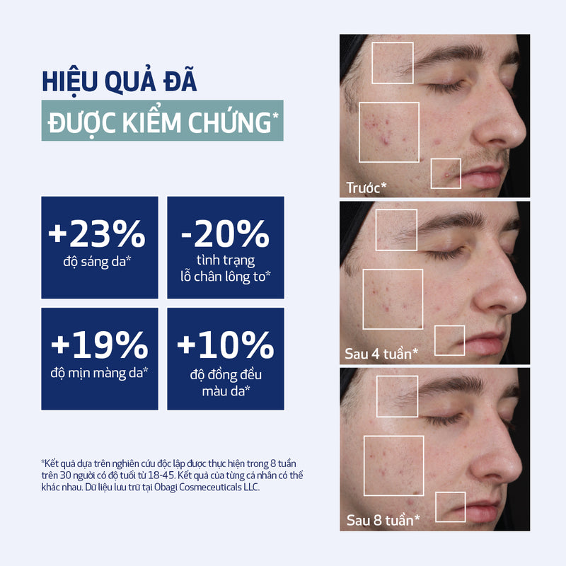 Miếng pad peel da làm sạch tế bào da chết và cải thiện bề mặt căng bóng CLENZIDERM M.D.® RESURFACING MULTI-ACID (30 miếng)