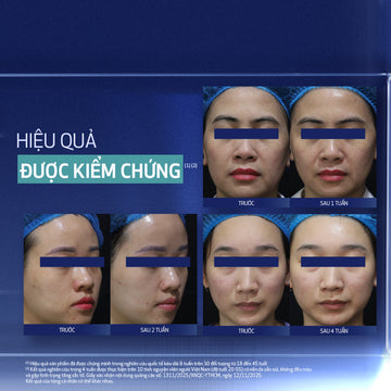 Kem dưỡng làm mới và duy trì độ tươi trẻ làn da ban đêm Obagi Medical Retinol + PHA