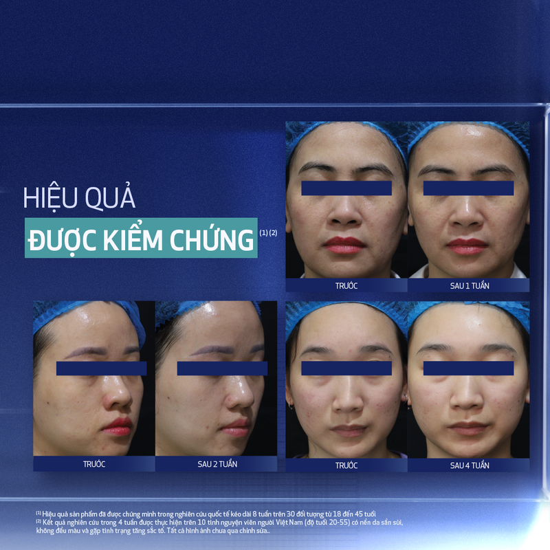 Kem dưỡng làm mới và duy trì độ tươi trẻ làn da ban đêm Obagi Medical Retinol + PHA